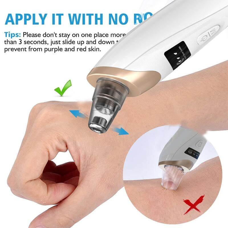 5 in 1 Electric Blackhead Remover Vacuum suction Face Pore Cleanser Facial beauty image 4