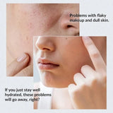 Anua Birch 70% Moisture Boosting Serum Korea image 3