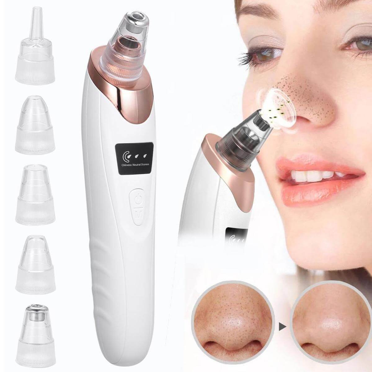 5 in 1 Electric Blackhead Remover Vacuum suction Face Pore Cleanser Facial beauty image 0