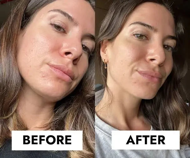 CeraVe Blemish Control Gel Moisturiser with 2% Salicylic Acid &amp; Niacinamide for Blemish-Prone Skin 40ml image 3