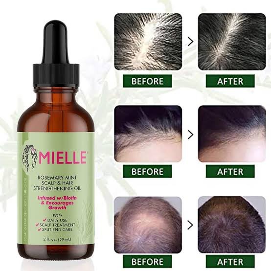 Mielle Rosemary Mint Scalp & Hair Strengthening Oil 59 - Ml image 2